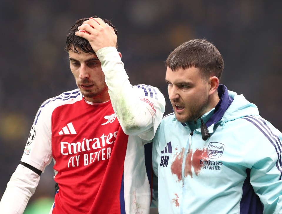 Kai Havertz está em dúvida para a viagem do Arsenal a Stamford Bridge, depois de levar pontos após um confronto de cabeças