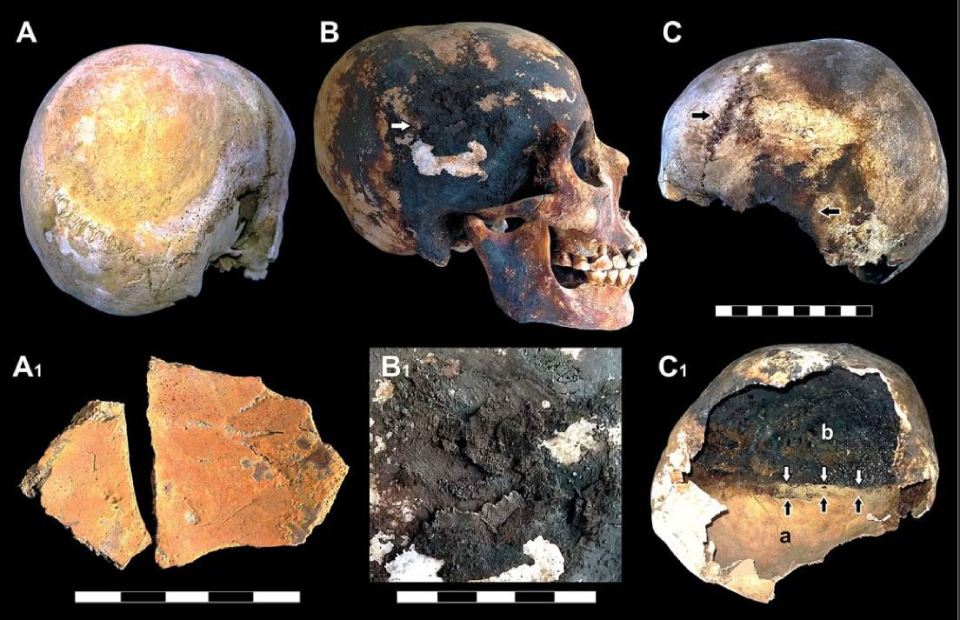 Alguns arqueólogos acham que esses crânios mostram sinais claros de explosão. Crédito: journals.plos.org