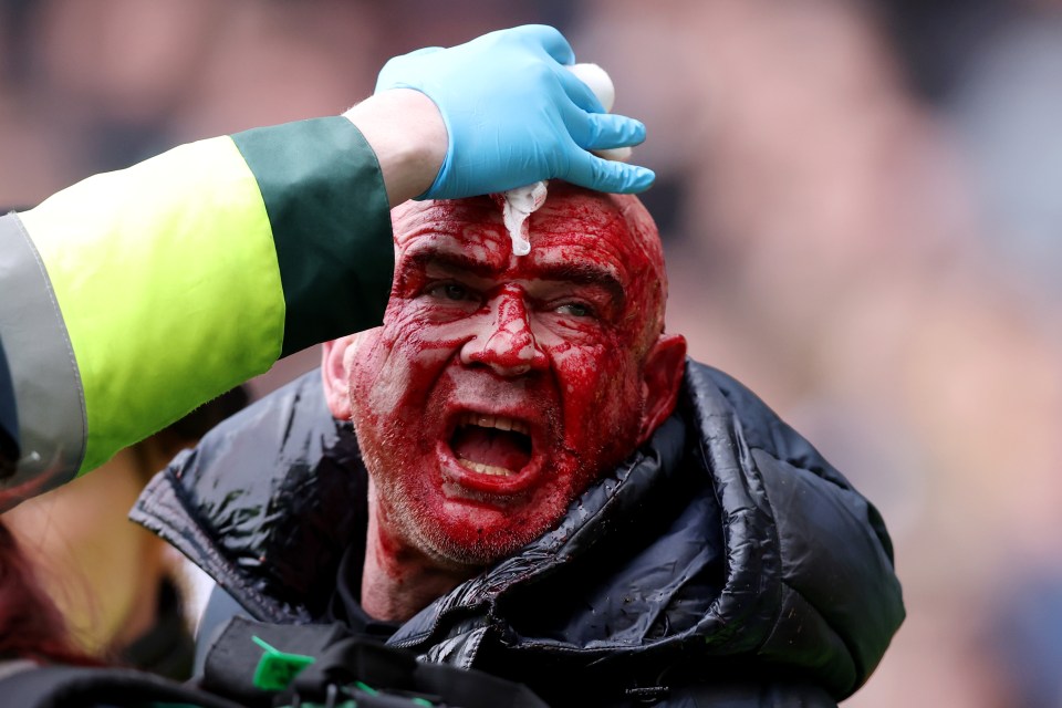 Um torcedor ensanguentado sendo escoltado pela polícia durante o confronto da FA Cup entre West Brom e Wolves, janeiro de 2024