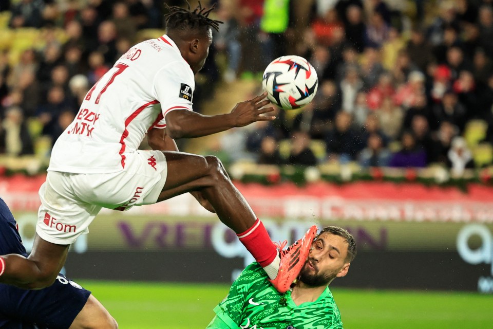 O goleiro do PSG foi atingido no rosto pelo zagueiro do Mônaco Wilfried Singo